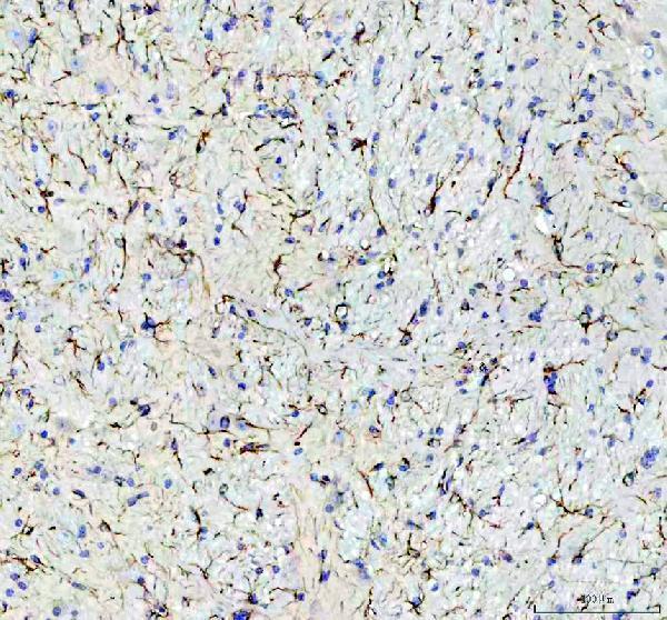 pa1239 gfap primary antibodies ihc testing 3_1