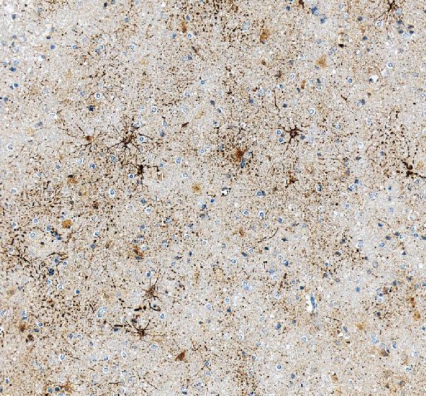 pa1239 gfap primary antibodies ihc testing 4