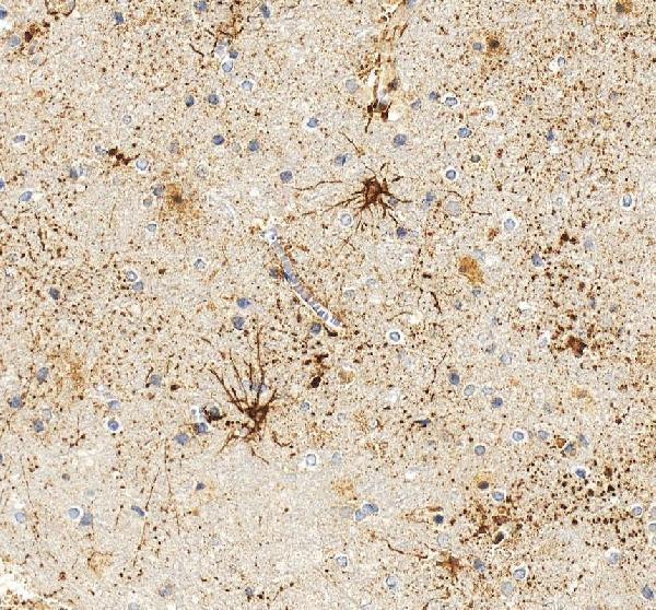 IHC analysis of GFAP using anti-GFAP antibody (PA1239)