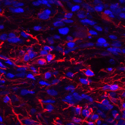 pa1239 gfap primary antibodies ihc testing 6