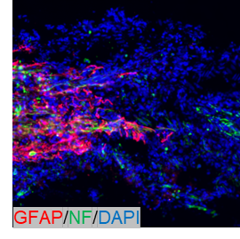 pa1239 gfap primary antibodies ihc testing 7