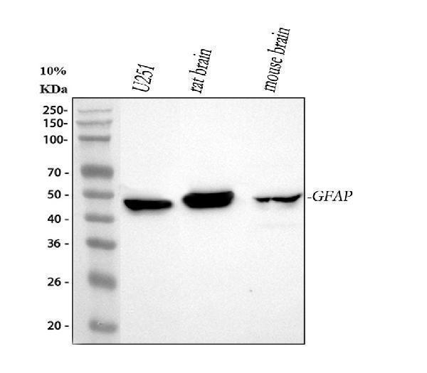  Western blot analysis of GFAP using anti-GFAP antibody (PA1239)