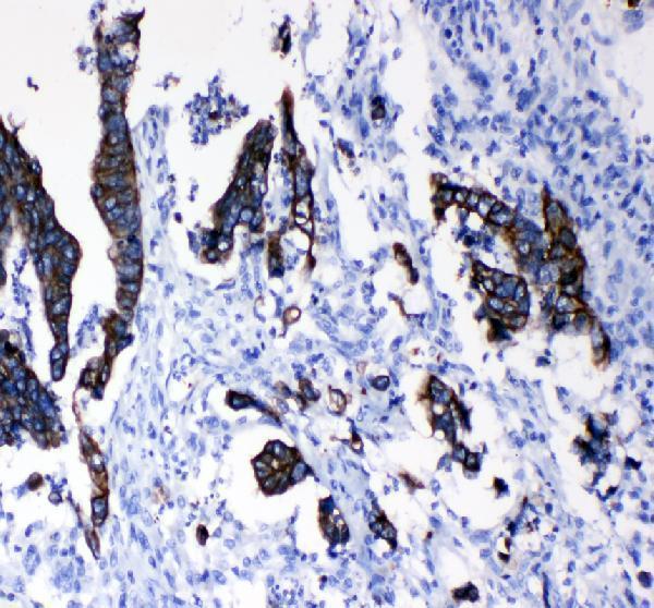  IHC analysis of ITGB3 using anti-ITGB3 antibody (PA1240)