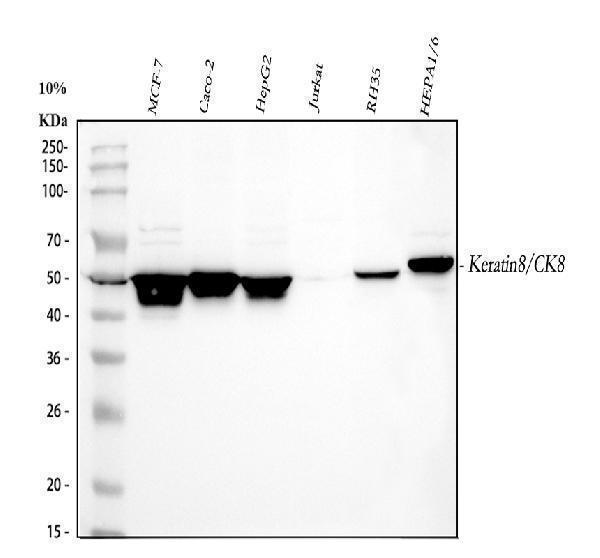  Western blot analysis of KRT8 using anti-KRT8 antibody (PA1240)