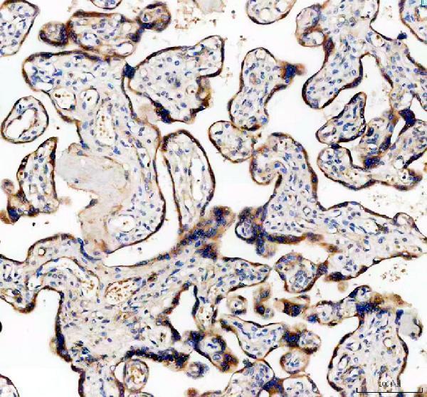 IHC analysis of TFPI2 using anti-TFPI2 antibody (PA1248)