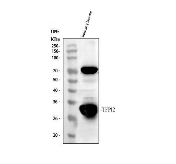 Western blot analysis of TFPI2 using anti-TFPI2 antibody (PA1248)