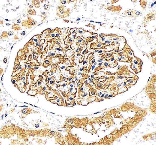 IHC analysis of NPHS2 using anti-NPHS2 antibody (PA1322-1)