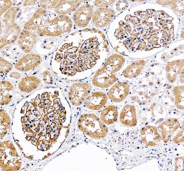 pa1322 1 nphs2 primary antibodies ihc testing 5