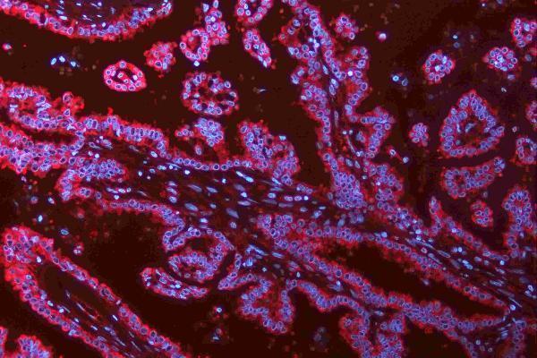 pa1328 cdh2 primary antibodies if testing 11