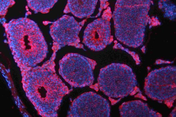 pa1328 cdh2 primary antibodies if testing 12
