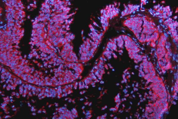 pa1328 cdh2 primary antibodies if testing 13