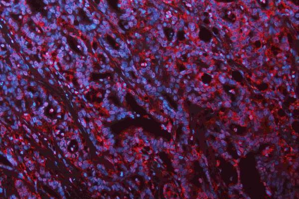 pa1328 cdh2 primary antibodies if testing 14