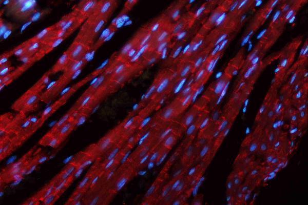 pa1328 cdh2 primary antibodies if testing 15