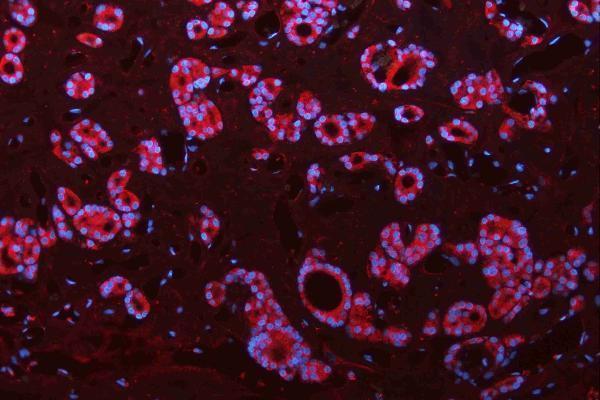 pa1328 cdh2 primary antibodies if testing 8