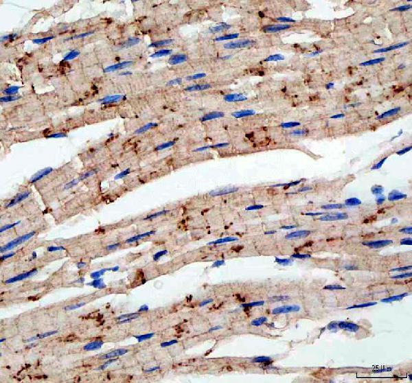 IHC analysis of CDH2 using anti-CDH2 antibody (PA1328)