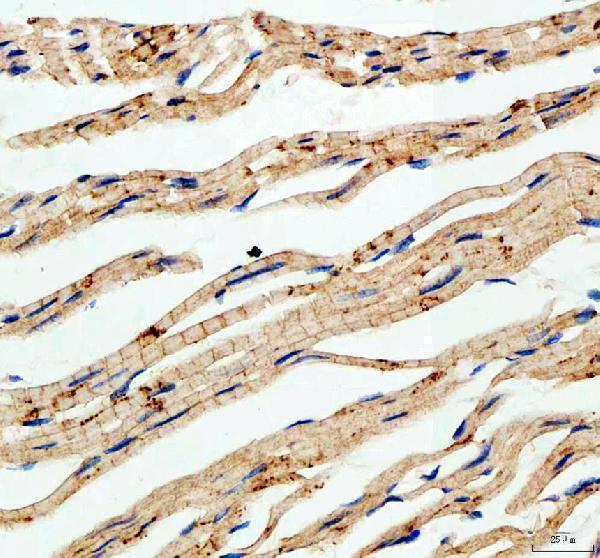 IHC analysis of CDH2 using anti-CDH2 antibody (PA1328)