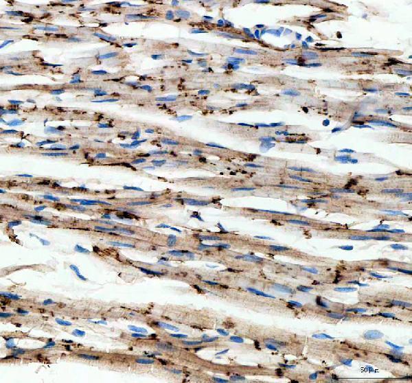 pa1328 cdh2 primary antibodies ihc testing 3_1