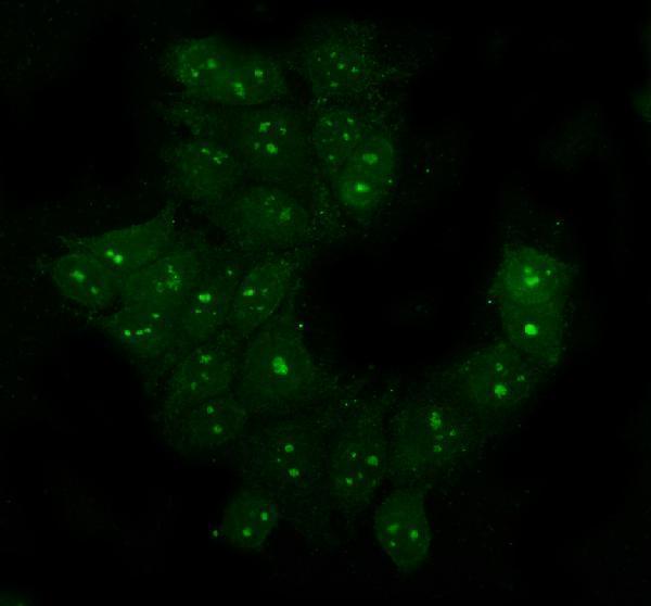 pa1345 sod1 primary antibodies if testing 7