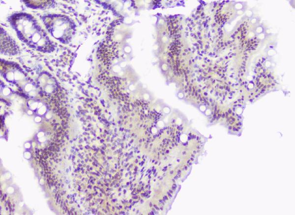 pa1345 sod1 primary antibodies ihc testing 4