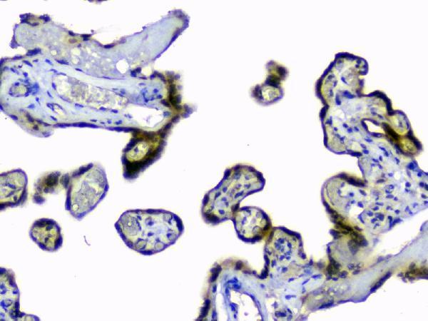 pa1345 sod1 primary antibodies ihc testing 5