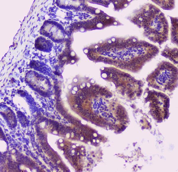 pa1345 sod1 primary antibodies ihc testing 6