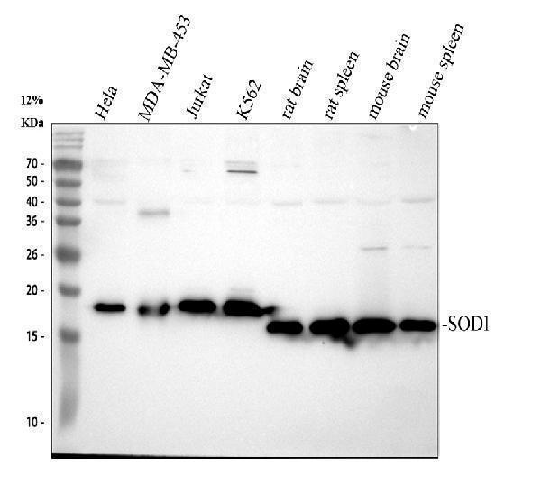 pa1345 sod1 primary antibodies wb testing 1