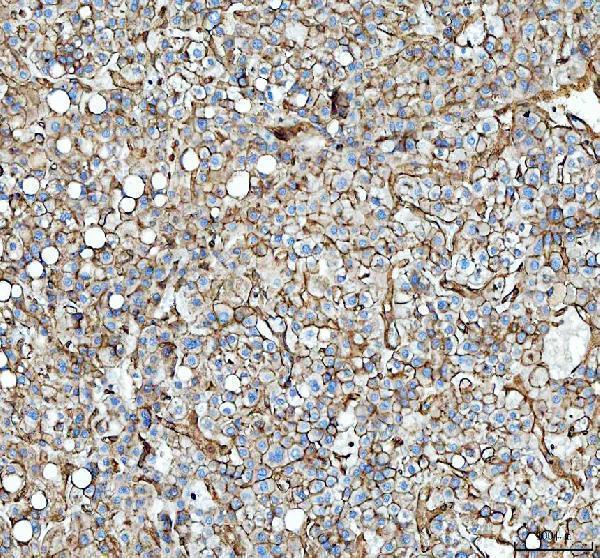 pa1348 anxa2 primary antibodies ihc testing 1