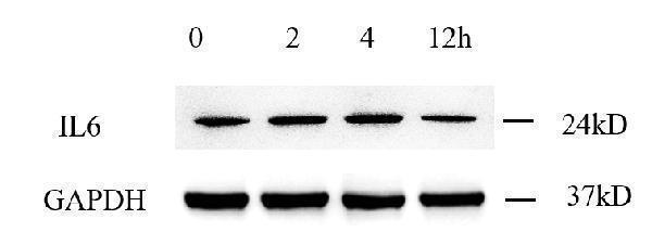 pa1352 il6 primary antibodies wb testing 4