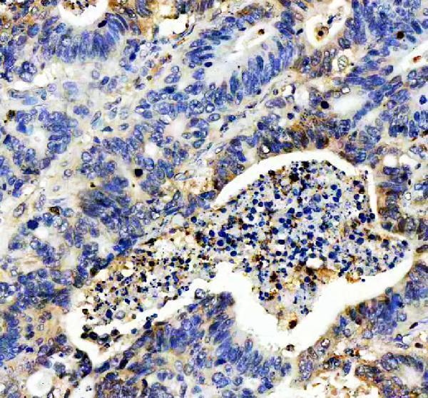  IHC analysis of IL8 using anti-IL8 antibody (PA1353)