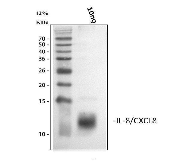  Western blot analysis of IL8 using anti-IL8 antibody (PA1353)