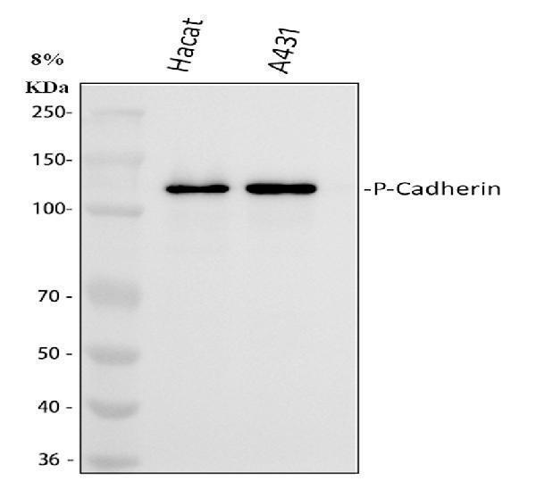  Western blot analysis of CDH3 using anti-CDH3 antibody (PA1363)