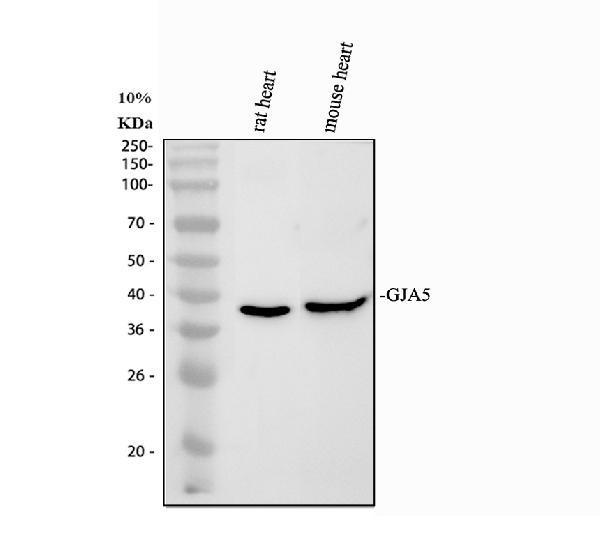 Western blot analysis of GJA5 using anti-GJA5 antibody (PA1368)
