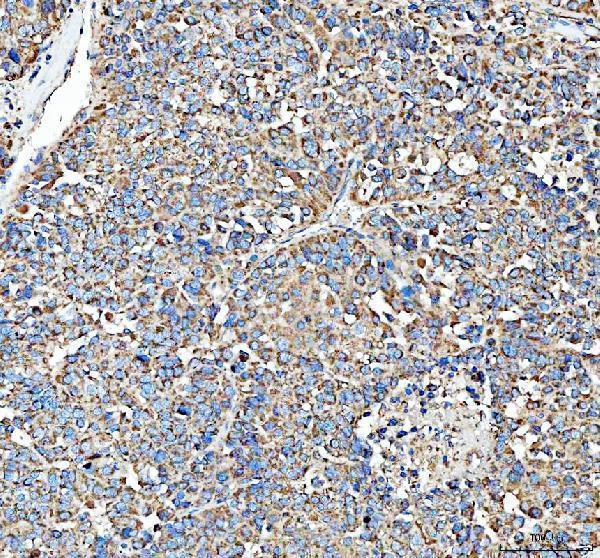 pa1372 1 hsd11b1 primary antibodies ihc testing 2