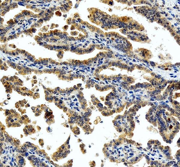 IHC analysis of MAP2K1 using anti-MAP2K1 antibody (PA1376)