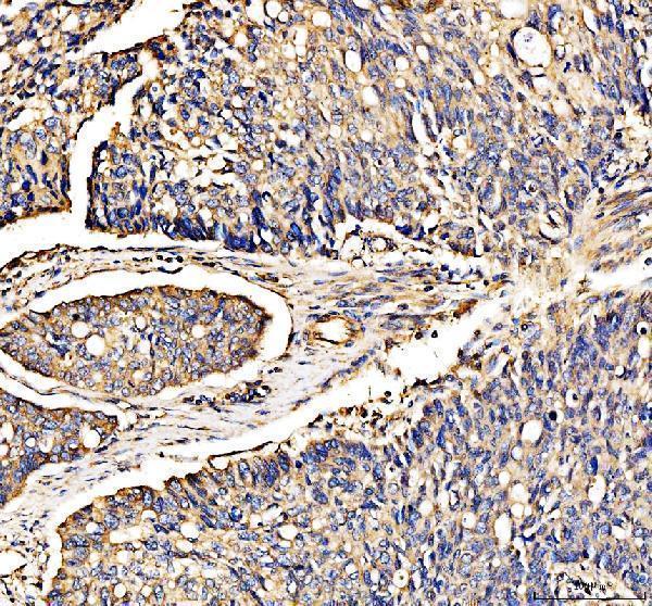 pa1377 map2k3 primary antibodies ihc testing 1