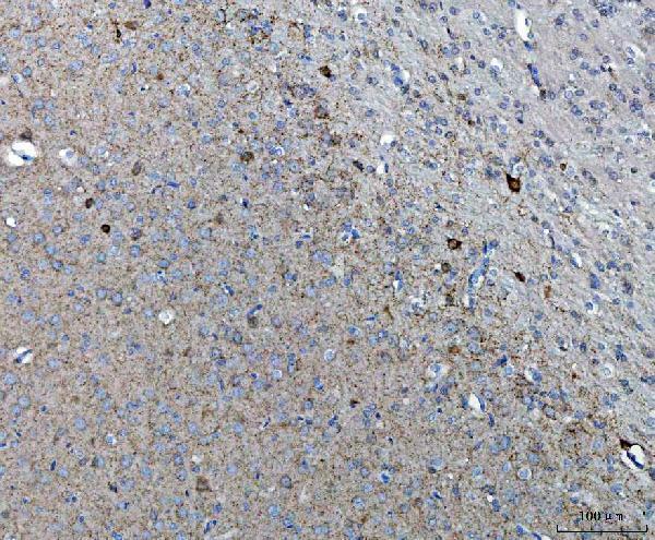  IHC analysis of GAD65/GAD2 using anti-GAD65/GAD2 antibody (PA1403)