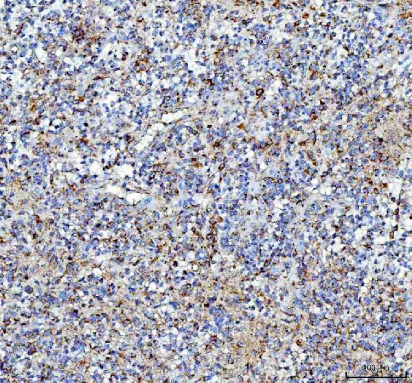 pa1414 ptn primary antibodies ihc testing 2
