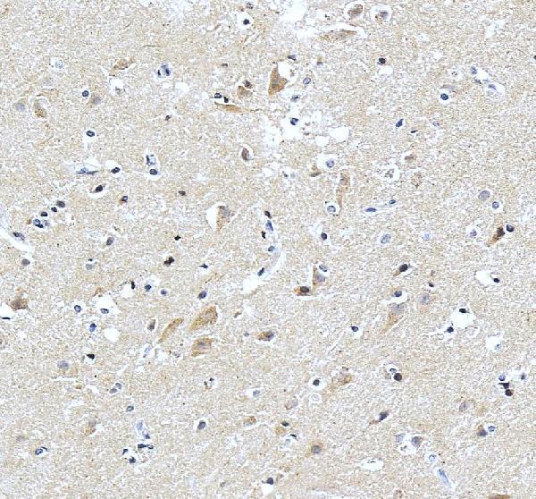pa1414 ptn primary antibodies ihc testing 3