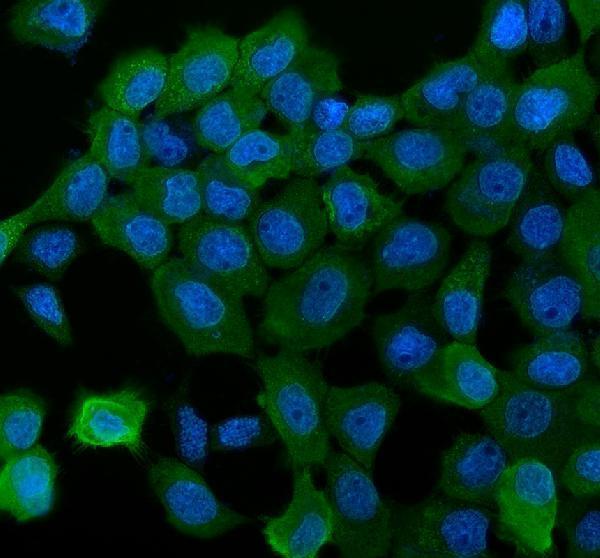 IF analysis of NDRG1 using anti-NDRG1 antibody (PA1416)