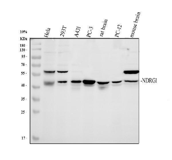 Western blot analysis of NDRG1 using anti-NDRG1 antibody (PA1416)