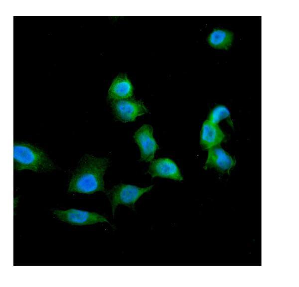 pa1422 lgals1 primary antibodies if testing 8_1