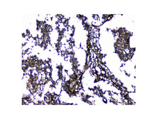 pa1422 lgals1 primary antibodies ihc testing 3_1