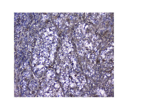 pa1422 lgals1 primary antibodies ihc testing 4_1