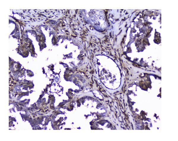 pa1422 lgals1 primary antibodies ihc testing 5_1
