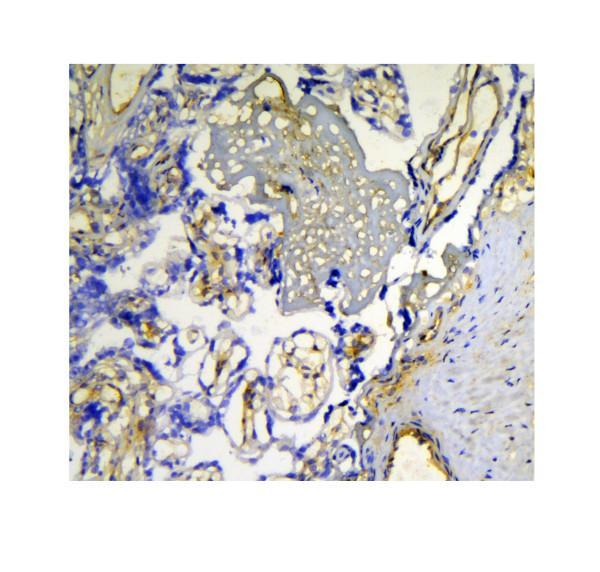 pa1422 lgals1 primary antibodies ihc testing 7_1