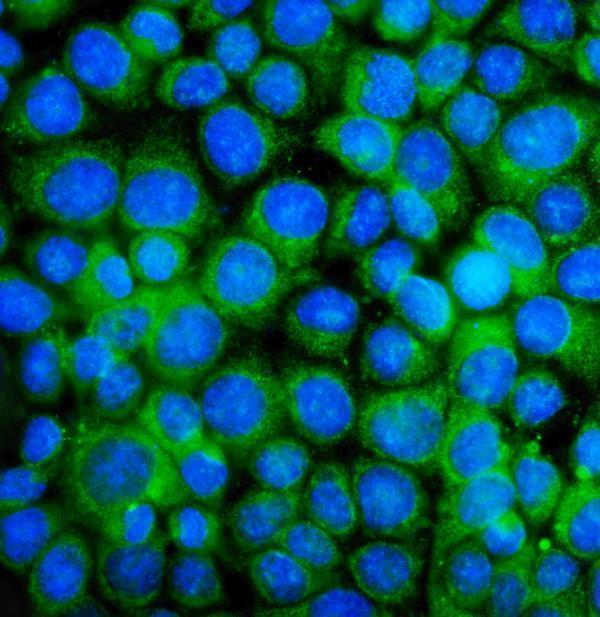 pa1437 bak1 primary antibodies if testing 4