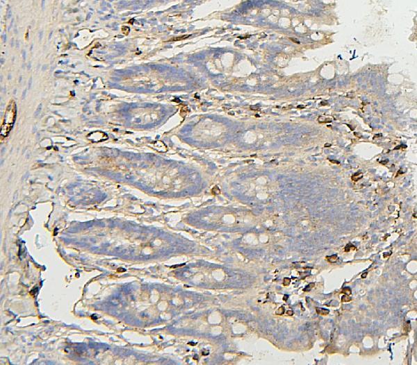 pa1437 bak1 primary antibodies ihc testing 2