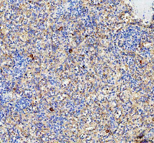 pa1446 cxcl4 primary antibodies ihc testing 1
