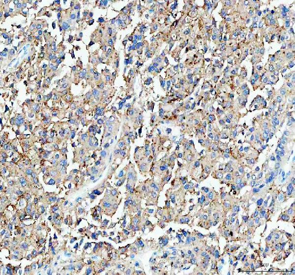 IHC analysis of DDT using anti-DDT antibody (PA1449)