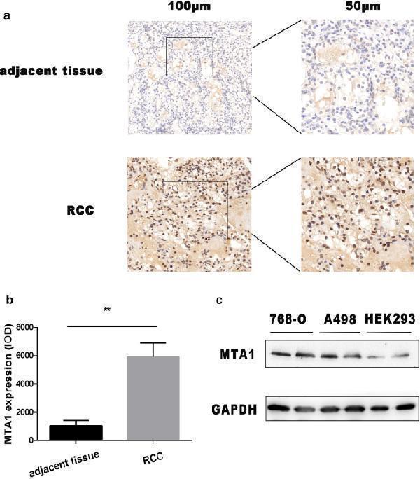 The expression of MTA1 is up-regulated in RCCs